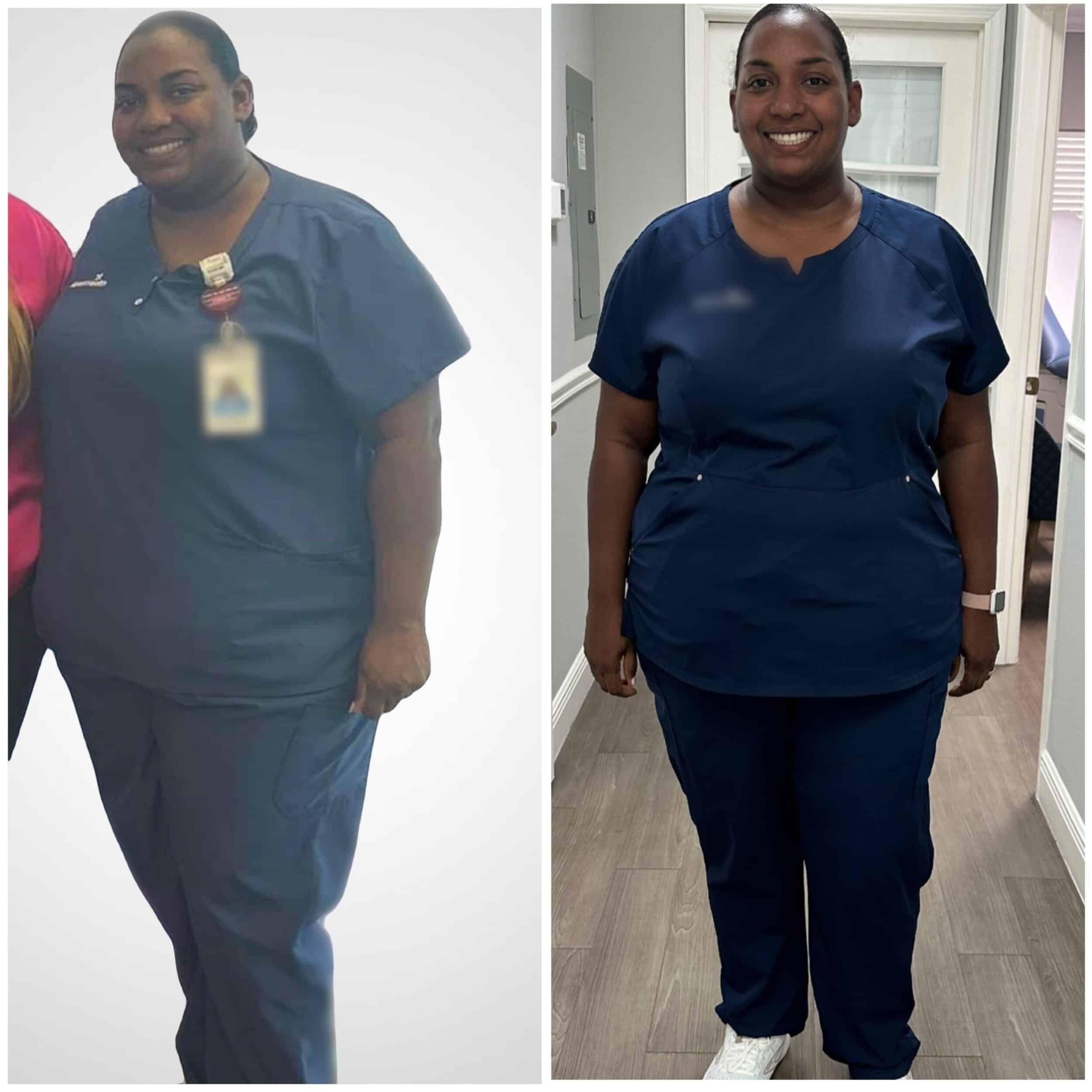 Before and After Image: Weight Loss - front