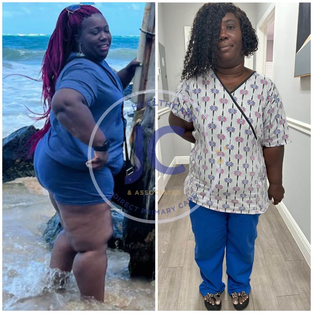 Before and After Image: Weight Loss - front